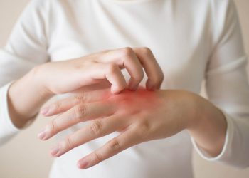Apa itu Alergi Dingin? Yuk Simak Penyebab, Gejala, dan Cara Mengobatinya